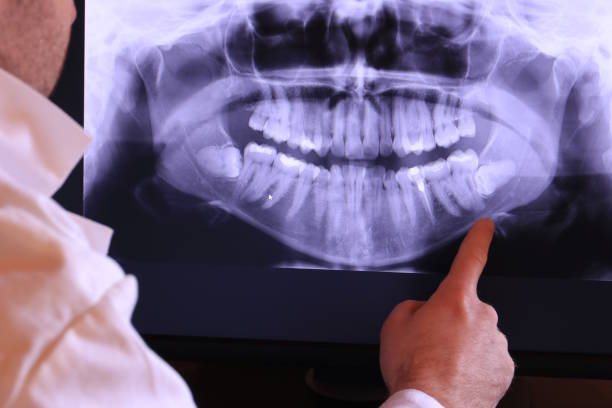 Best Urgent Dental Care for Toothache in Sweet Home, AR